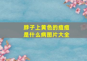 脖子上黄色的痘痘是什么病图片大全