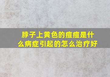 脖子上黄色的痘痘是什么病症引起的怎么治疗好