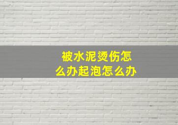 被水泥烫伤怎么办起泡怎么办