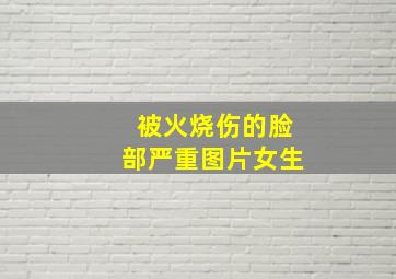 被火烧伤的脸部严重图片女生