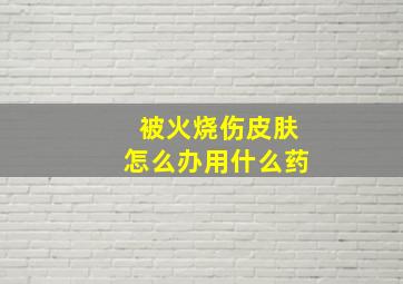 被火烧伤皮肤怎么办用什么药