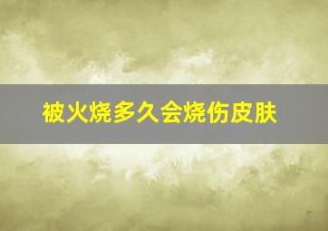 被火烧多久会烧伤皮肤