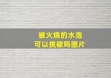 被火烧的水泡可以挑破吗图片