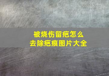 被烧伤留疤怎么去除疤痕图片大全