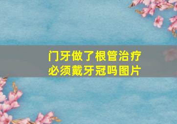 门牙做了根管治疗必须戴牙冠吗图片