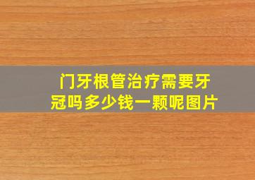 门牙根管治疗需要牙冠吗多少钱一颗呢图片