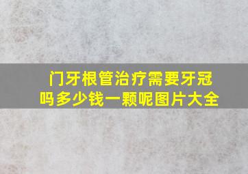 门牙根管治疗需要牙冠吗多少钱一颗呢图片大全