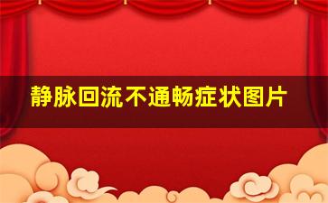 静脉回流不通畅症状图片