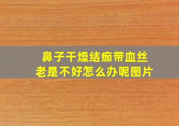 鼻子干燥结痂带血丝老是不好怎么办呢图片