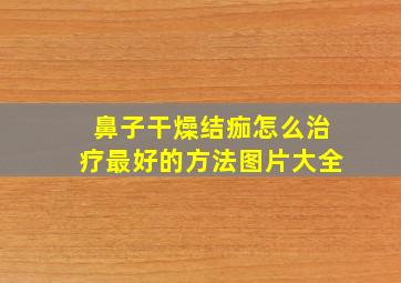 鼻子干燥结痂怎么治疗最好的方法图片大全