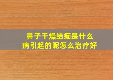 鼻子干燥结痂是什么病引起的呢怎么治疗好