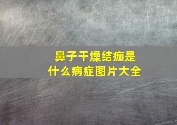 鼻子干燥结痂是什么病症图片大全