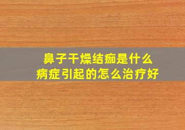 鼻子干燥结痂是什么病症引起的怎么治疗好