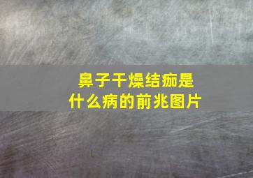 鼻子干燥结痂是什么病的前兆图片