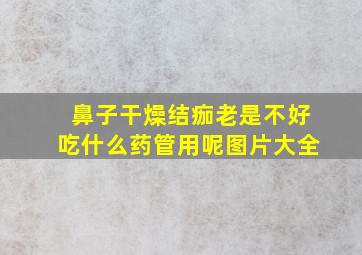 鼻子干燥结痂老是不好吃什么药管用呢图片大全