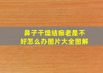 鼻子干燥结痂老是不好怎么办图片大全图解