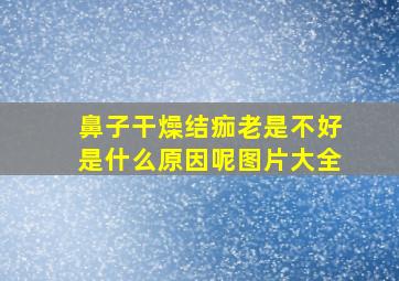 鼻子干燥结痂老是不好是什么原因呢图片大全