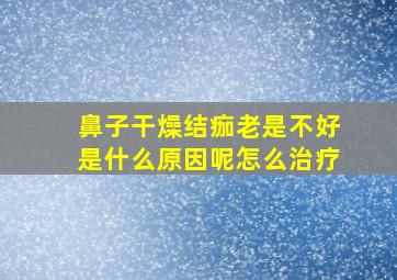 鼻子干燥结痂老是不好是什么原因呢怎么治疗