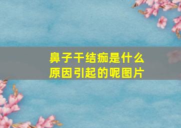 鼻子干结痂是什么原因引起的呢图片