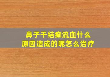 鼻子干结痂流血什么原因造成的呢怎么治疗