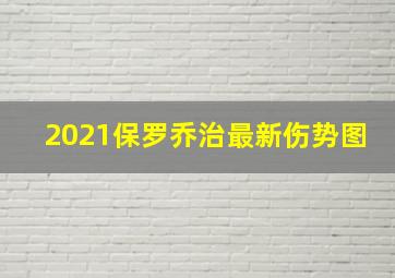 2021保罗乔治最新伤势图