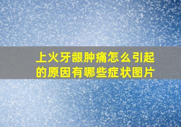 上火牙龈肿痛怎么引起的原因有哪些症状图片