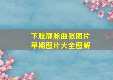 下肢静脉曲张图片早期图片大全图解