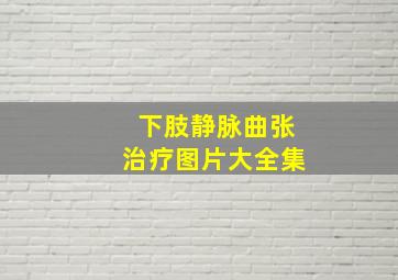 下肢静脉曲张治疗图片大全集