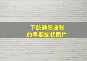 下肢静脉曲张的早期症状图片