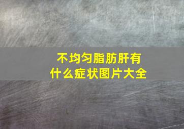 不均匀脂肪肝有什么症状图片大全