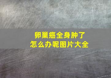 卵巢癌全身肿了怎么办呢图片大全