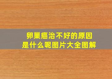 卵巢癌治不好的原因是什么呢图片大全图解