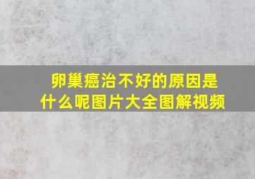 卵巢癌治不好的原因是什么呢图片大全图解视频