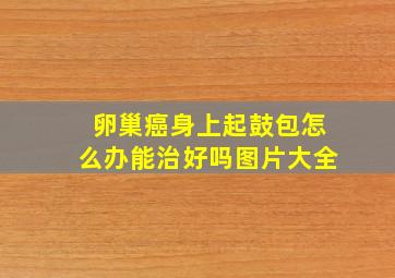 卵巢癌身上起鼓包怎么办能治好吗图片大全