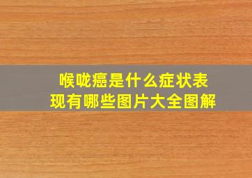 喉咙癌是什么症状表现有哪些图片大全图解