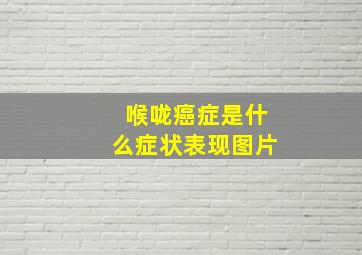 喉咙癌症是什么症状表现图片