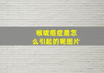 喉咙癌症是怎么引起的呢图片