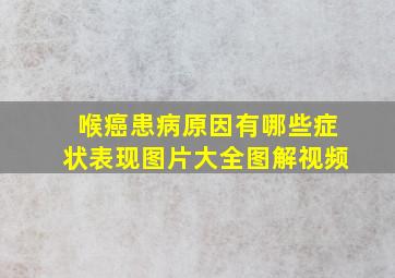 喉癌患病原因有哪些症状表现图片大全图解视频