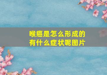 喉癌是怎么形成的有什么症状呢图片