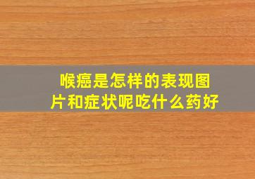 喉癌是怎样的表现图片和症状呢吃什么药好