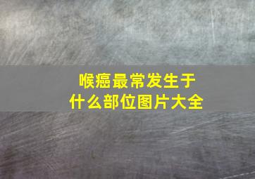 喉癌最常发生于什么部位图片大全