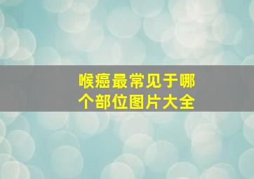 喉癌最常见于哪个部位图片大全