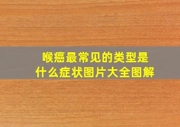 喉癌最常见的类型是什么症状图片大全图解