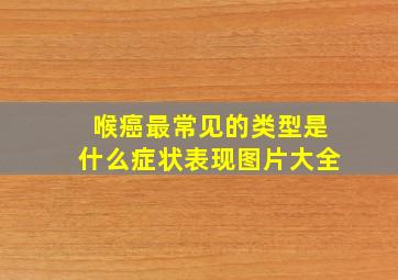 喉癌最常见的类型是什么症状表现图片大全