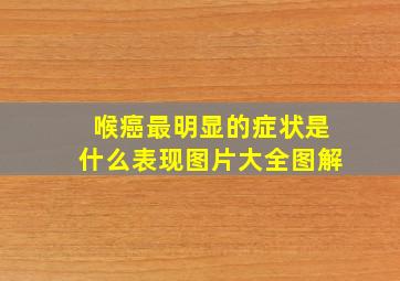 喉癌最明显的症状是什么表现图片大全图解