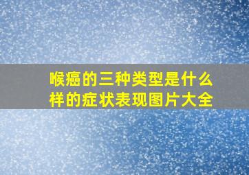 喉癌的三种类型是什么样的症状表现图片大全