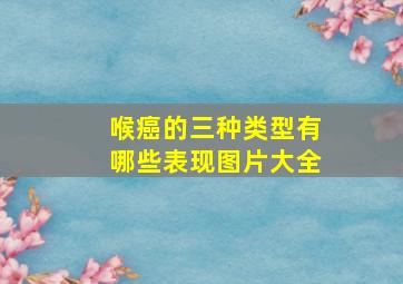 喉癌的三种类型有哪些表现图片大全