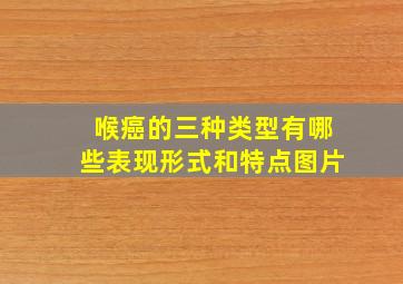 喉癌的三种类型有哪些表现形式和特点图片