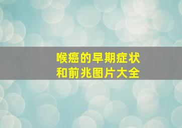 喉癌的早期症状和前兆图片大全