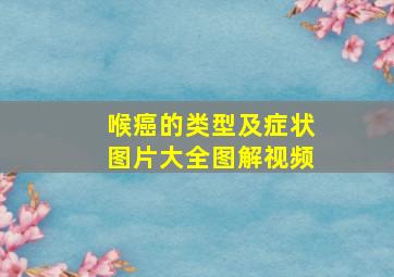 喉癌的类型及症状图片大全图解视频